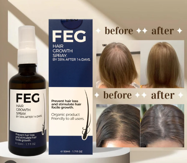 FEG Hair Growth Spray Stop Hair Fall & Regrow Naturally | 03001819306